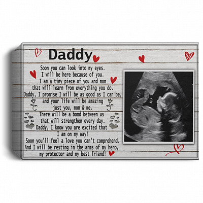 1.5'' Deluxe Canvas
