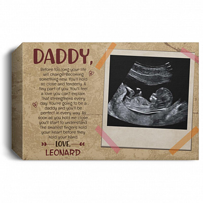 1.5'' Deluxe Canvas